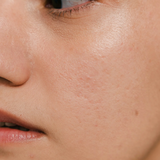 Why your skin barrier is struggling