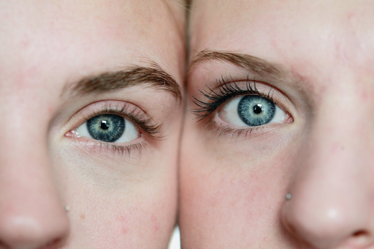 What is my Skin Type?